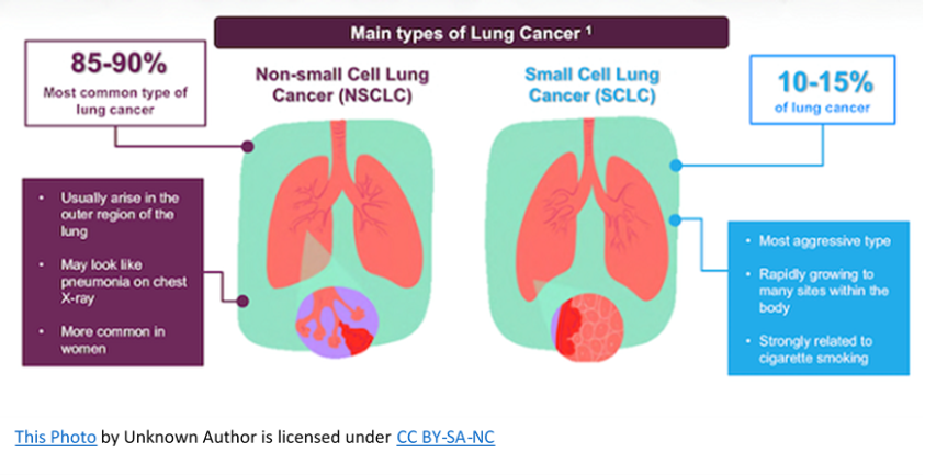 Types Of Lung Cancer Tumors